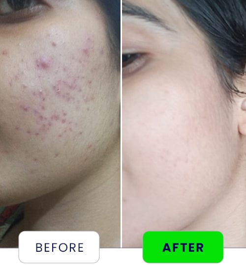 Glow expert night cream