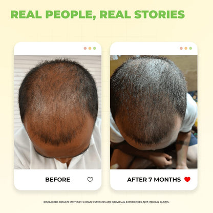 Ronaq-e-Zulf Hair Oil | Reduces Hair Fall | Promotes Hair Growth