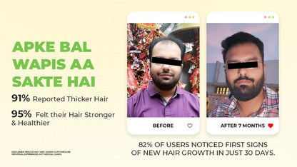 Ronaq-e-Zulf Hair Oil | Reduces Hair Fall | Promotes Hair Growth