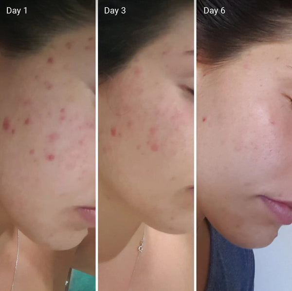 Face Cream + Face Wash By MF Products